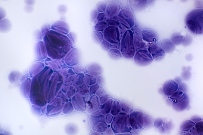 Effet de la digestion de grains d'amidon de Pomme de terre par l'amylase x100